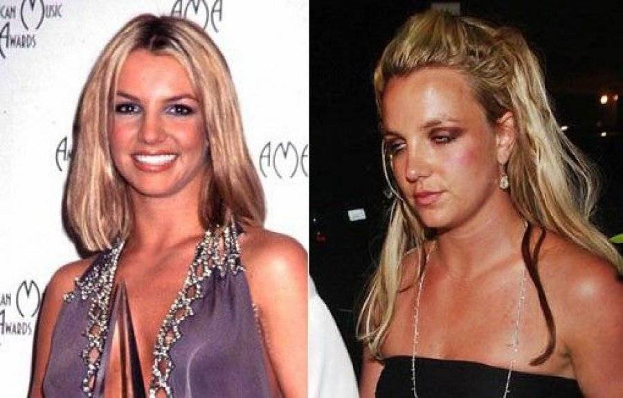 13 звезди преди и след удара на наркотиците 