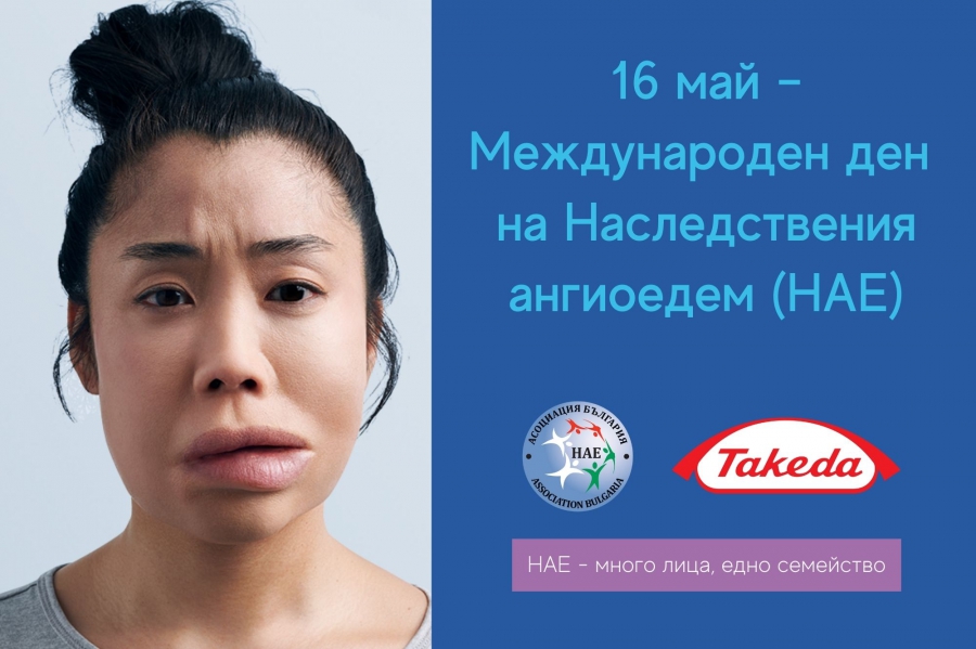 наследствен ангиоедем