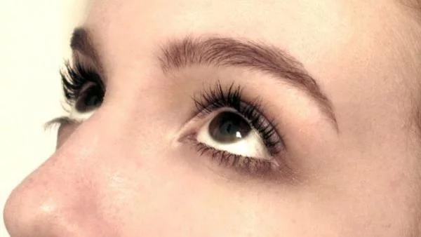 Пластична операция на веждите помага при мигрена 