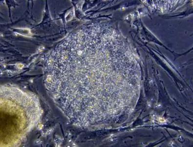 Клонираха човешки стволови клетки