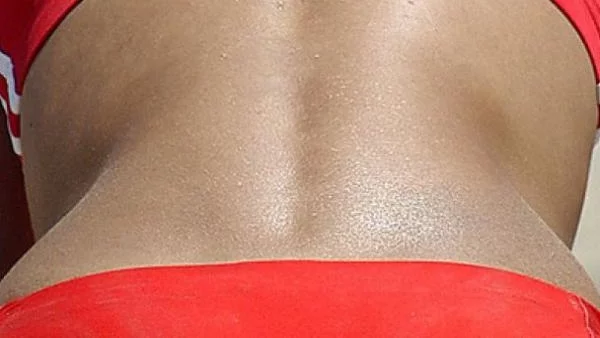 Гъбички и зарази дебнат на плажа