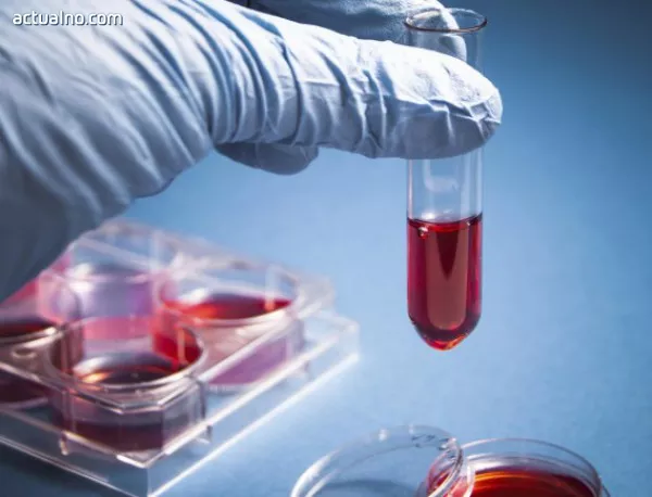 Учени откриха протеин, който може да съхранява кръвта за операции по-дълго