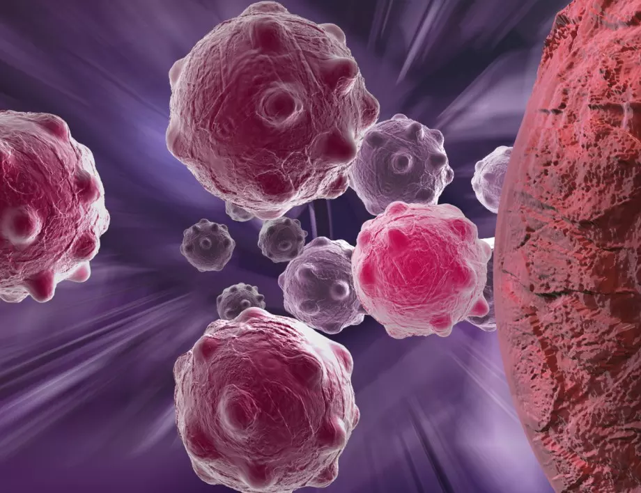 Учени създадоха нанопрепарат, който убива раковите клетки в млечните жлези