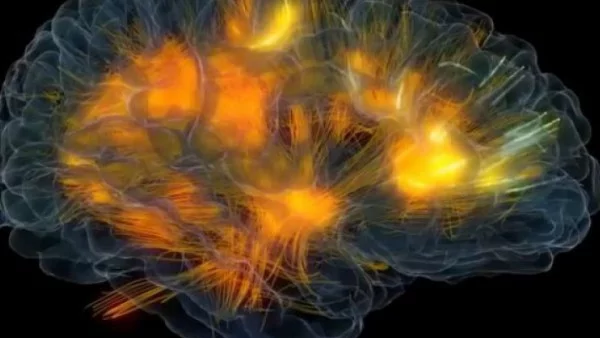 Обезглавен, но жив - учени отложиха смъртта на мозъка