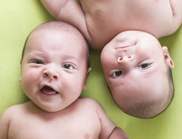 Жена роди близнаци от двама бащи
