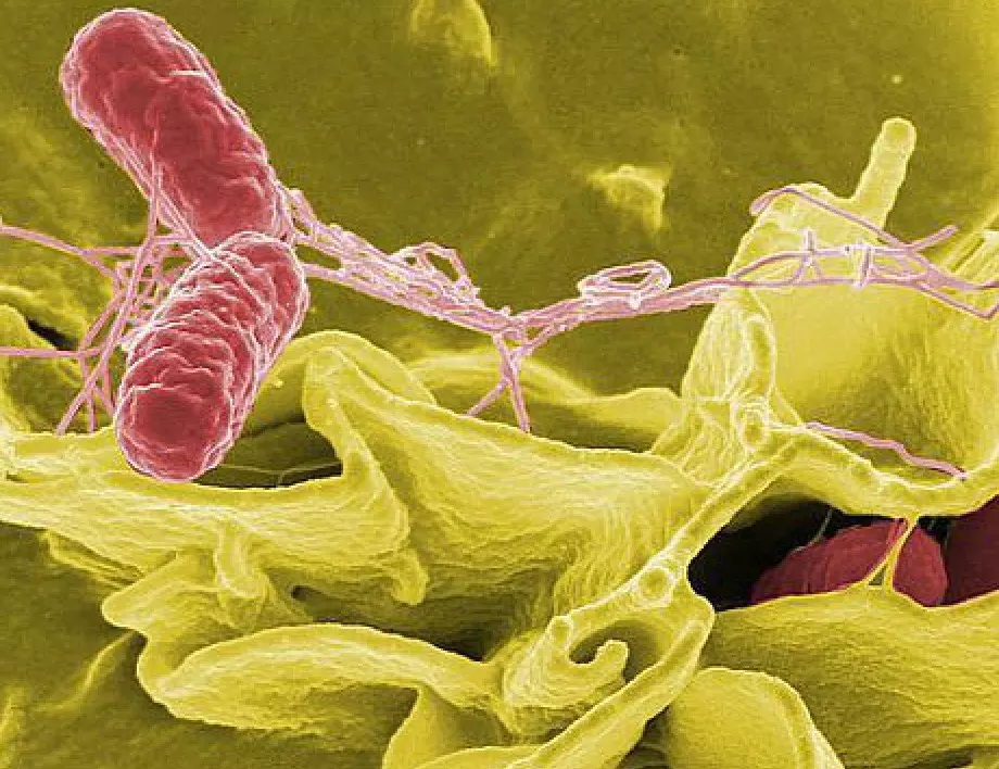 Какъв е бил животът преди да разберем за микробите?