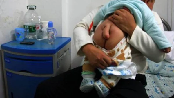 Китайска родилка обезумя, след като на новороденото й дете му израснала опашка