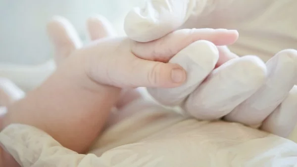 Бебе с две лица се роди в Австралия