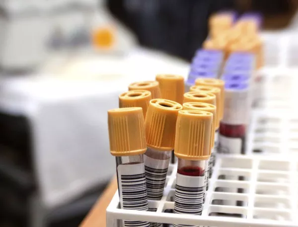Кръвен тест ще открива рак в начален стадий
