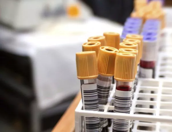 Нов кръвен тест ще улесни диагностицирането на туберкулоза
