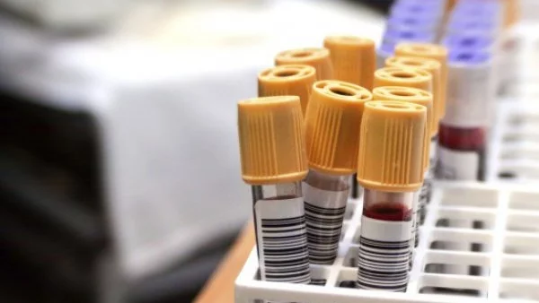Нов кръвен тест ще улесни диагностицирането на туберкулоза