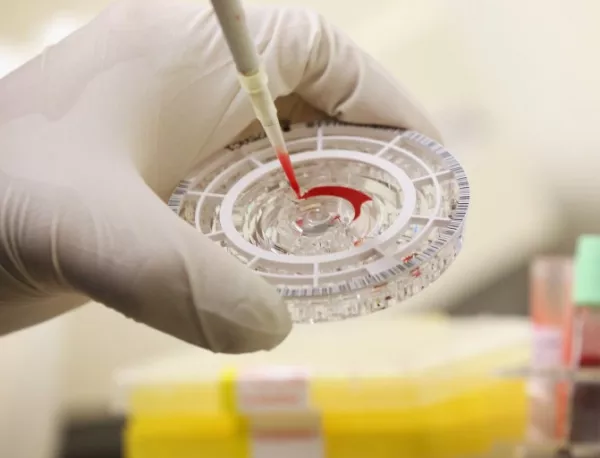 Япония разработи 30-минутен метод за откриване на ебола
