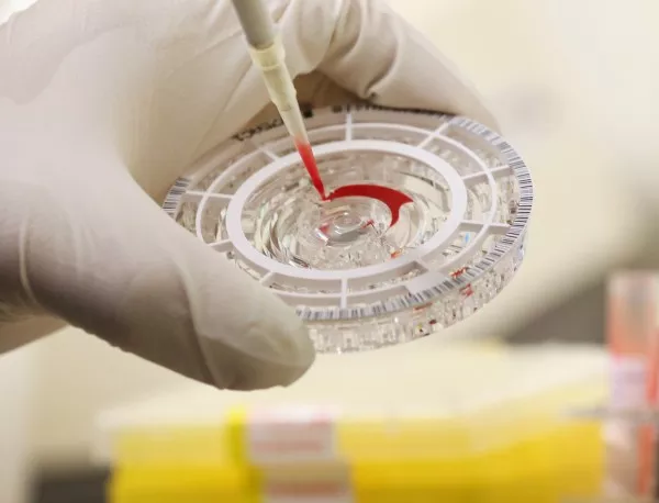 Състоянието на болната от ебола испанска санитарка се подобрява