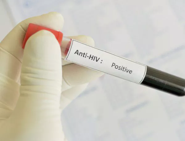 Досега през 2015 г. близо 1500 души са се тествали за ХИВ и СПИН в Сливен 
