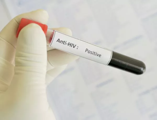 2247 души в България са носители на ХИВ