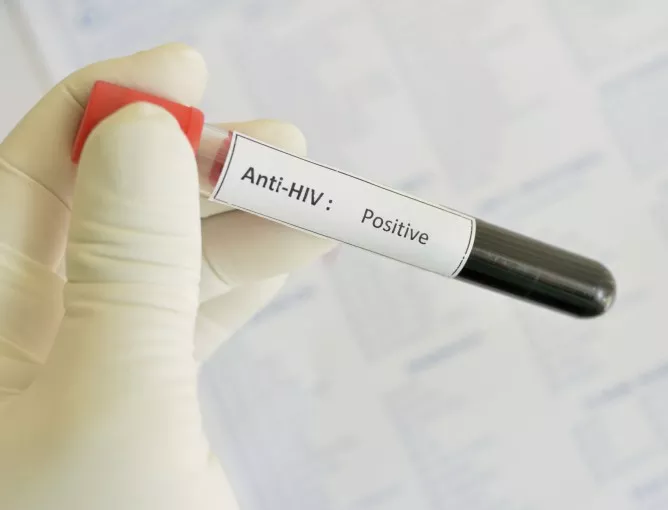 88% от хората с ХИВ у нас са се заразили по сексуален път