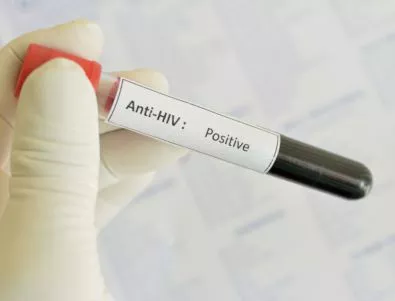 Вирусът на СПИН мутира и отслабва