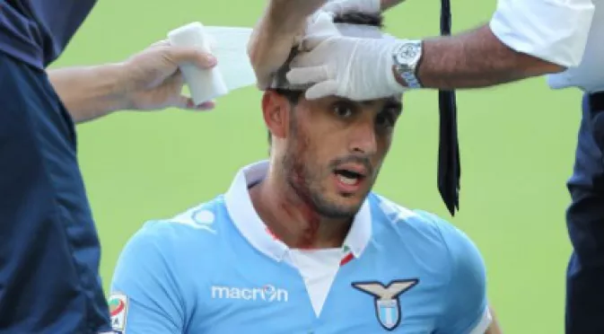 Най-тежката контузия във футбола застигна защитник на Лацио
