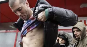 Николич показа рани и обяви: Моци ме ритна умишлено!