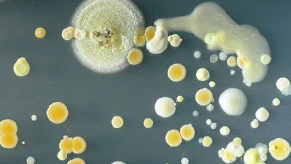 Потресаващи снимки разкриват колко мръсен е смартфонът ви