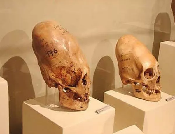 Тайната на продълговатите черепи от Паракас