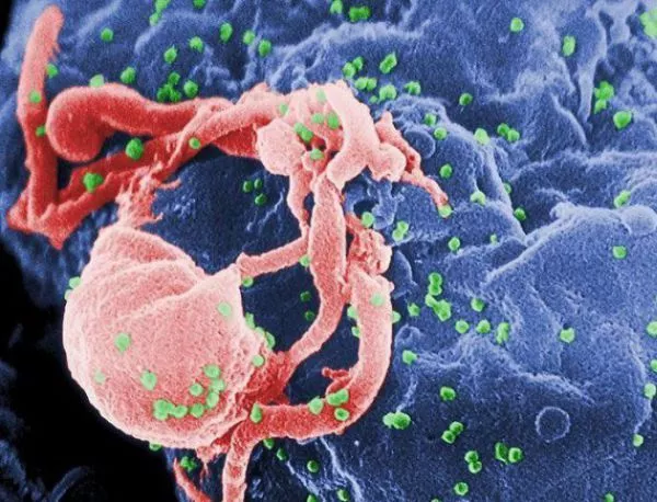 Медиците се научиха да гонят ХИВ от клетките