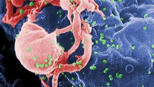 Медиците се научиха да гонят ХИВ от клетките