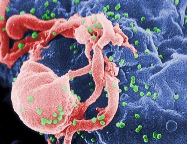 В Пакистан задържаха лекар, заразил десетки с ХИВ