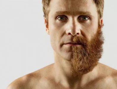 Британците харчат хиляди за присаждане на брада 