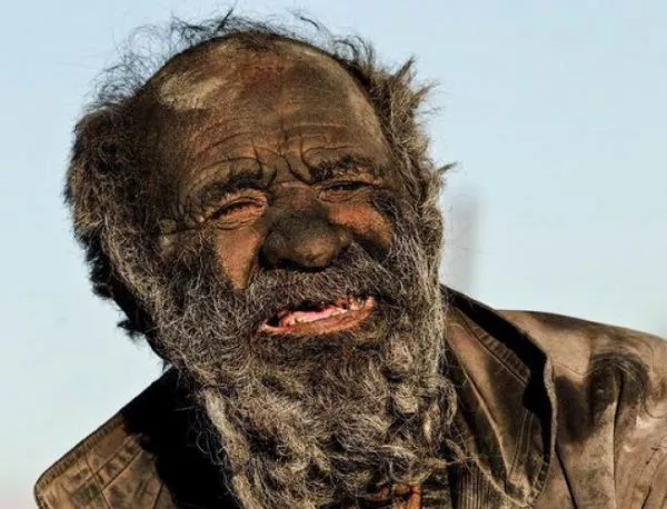 Вижте как изглежда човек, който не се е къпал 60 години (СНИМКИ)