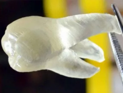 3D печатани зъби убиват бактериите