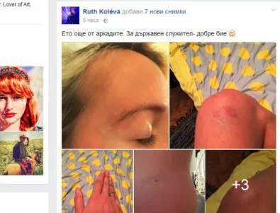 Рут Колева публикува видео от боя, показа и медицинско (Видео)
