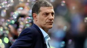 Спипаха Билич, че си е присаждал коса