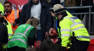 Бой между фенове на Англия-Шотландия (СНИМКИ И ВИДЕО)