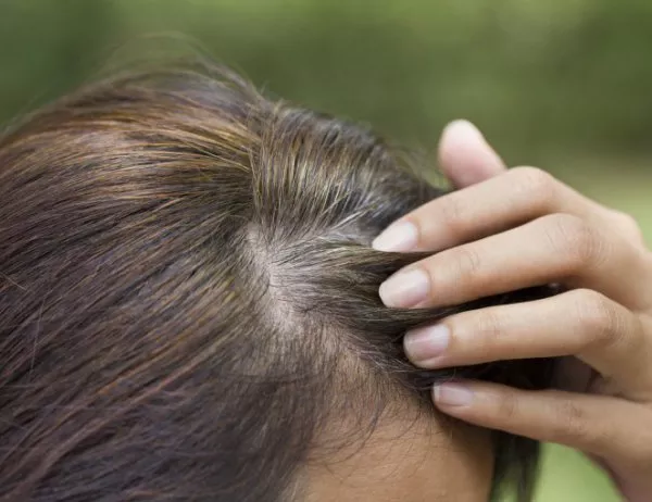 Посивяването на косите показва повишен риск от инфаркт