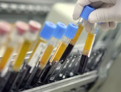 Държавата не може да прави бързи ДНК анализи и плаща големи суми на частна лаборатория