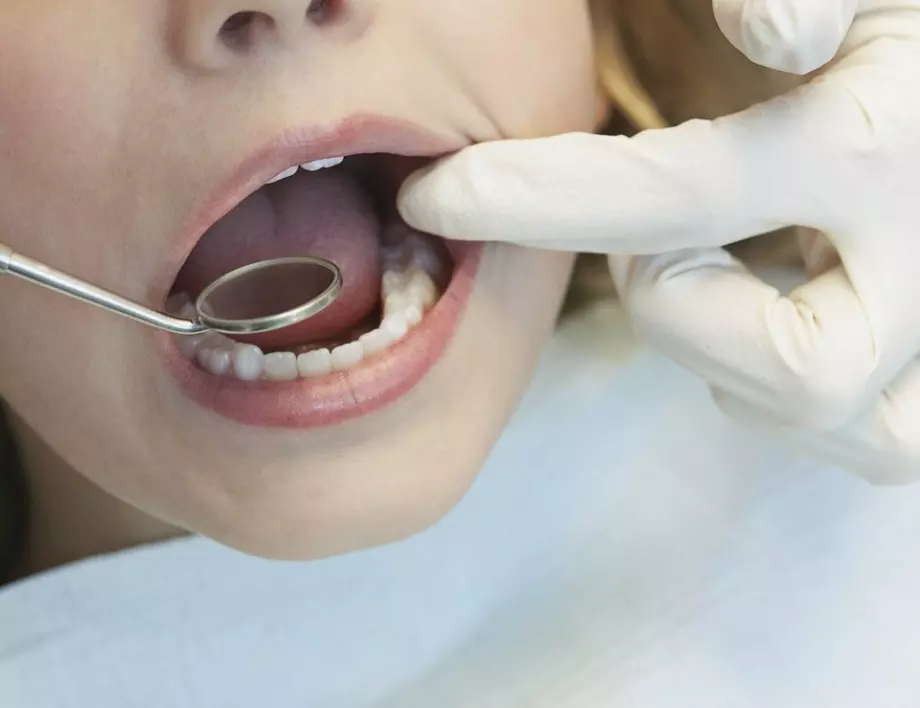 Николай Шарков: Зъболекарите няма как да работим, ако защитните средства свършат 