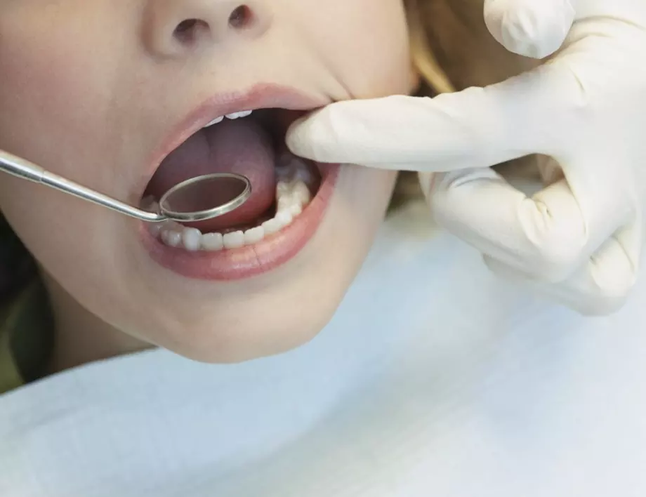 Развалените зъби отключват куп опасни заболявания