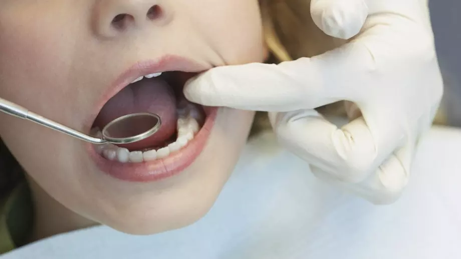 Опасни ли са белите петна по зъбите?