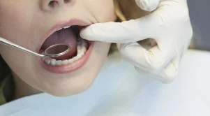 Здравната каса няма да поема на 100% зъбните протези 