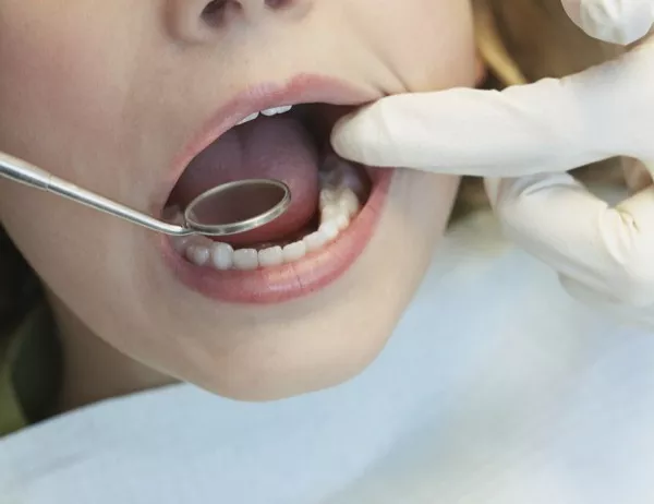 Временните детски зъби също трябва да се лекуват