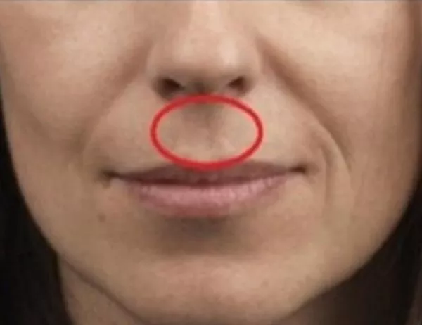 Имате ли това между носа и горната устна? Знаете ли какво означава то?