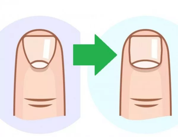 Какво означават белите петънца по ноктите?