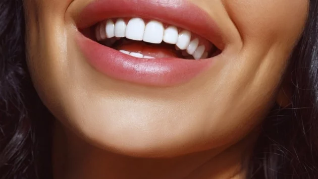 Как да запазим зъбите си бели