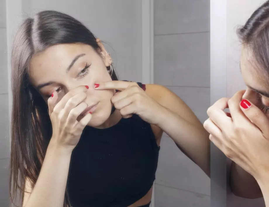 С тези храни ще забравите завинаги за пъпките по лицето