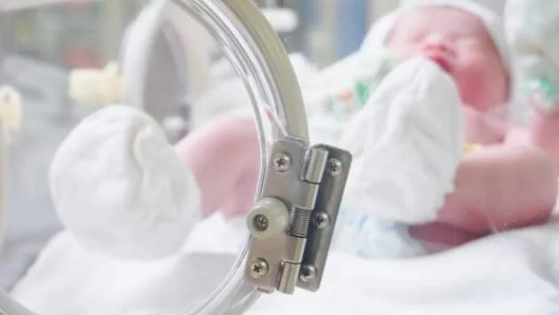 Жена с перфориран апендикс роди близнаци 
