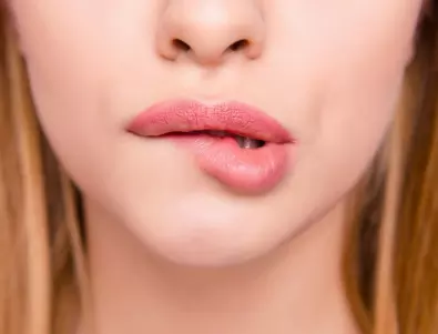 Този симптом с устните издава дефицита на важен витамин