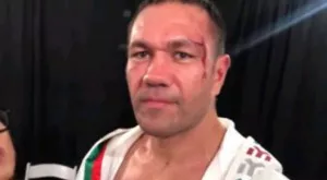 Кобрата изненада: Аркадата ми е красива (ВИДЕО)