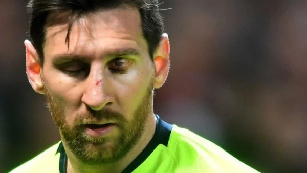 Меси изглежда е с фрактура, ето колко ще отсъства от терена