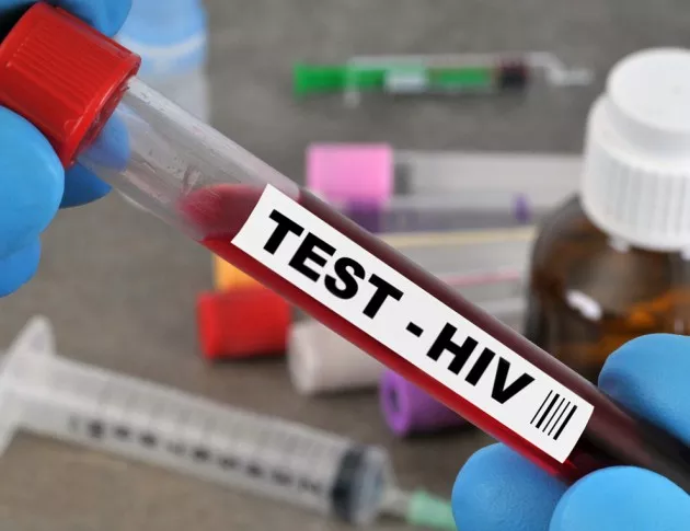 Изкореняването на ХИВ е в застой